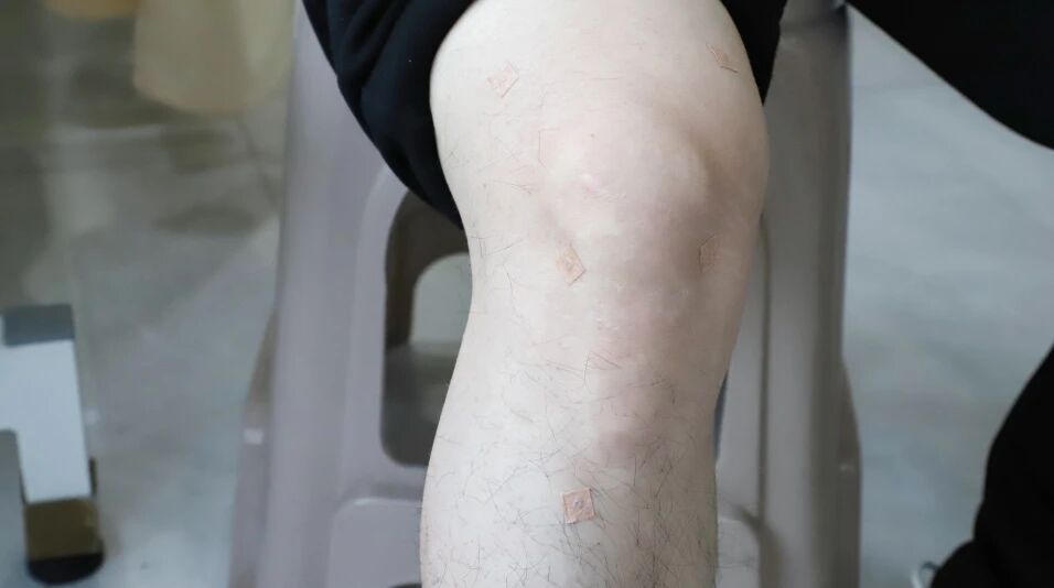 人老膝先衰？杭州东方华康康复医院中医科：中医智慧守护 “膝” 望