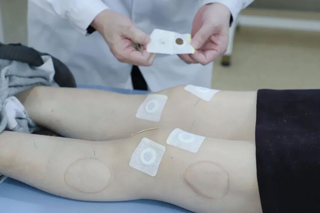 睡不好，睡不着？杭州东方华康康复医院中医康复门诊：试试这些中医特色疗法 