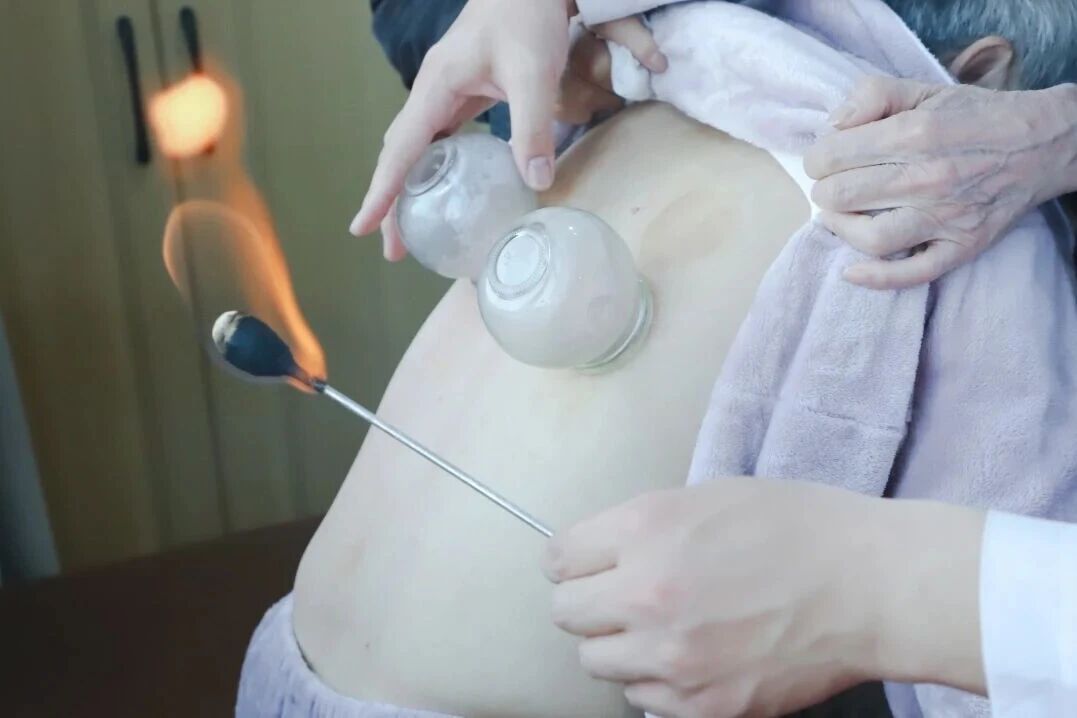 不止针灸艾灸！杭州东方华康中医康复，多疗法护航术后与慢病康复